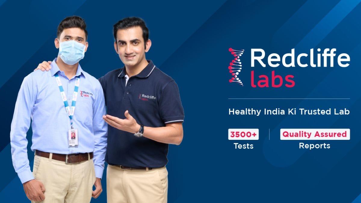 "Comprehensive Cbc Test Services In Delhi: Ensuring Your Health And Well-Being"